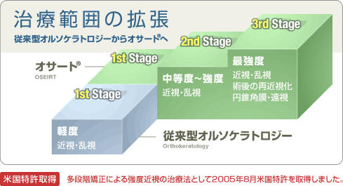 治療範囲の拡張 従来型オルソケラトロジーからオサート®へ